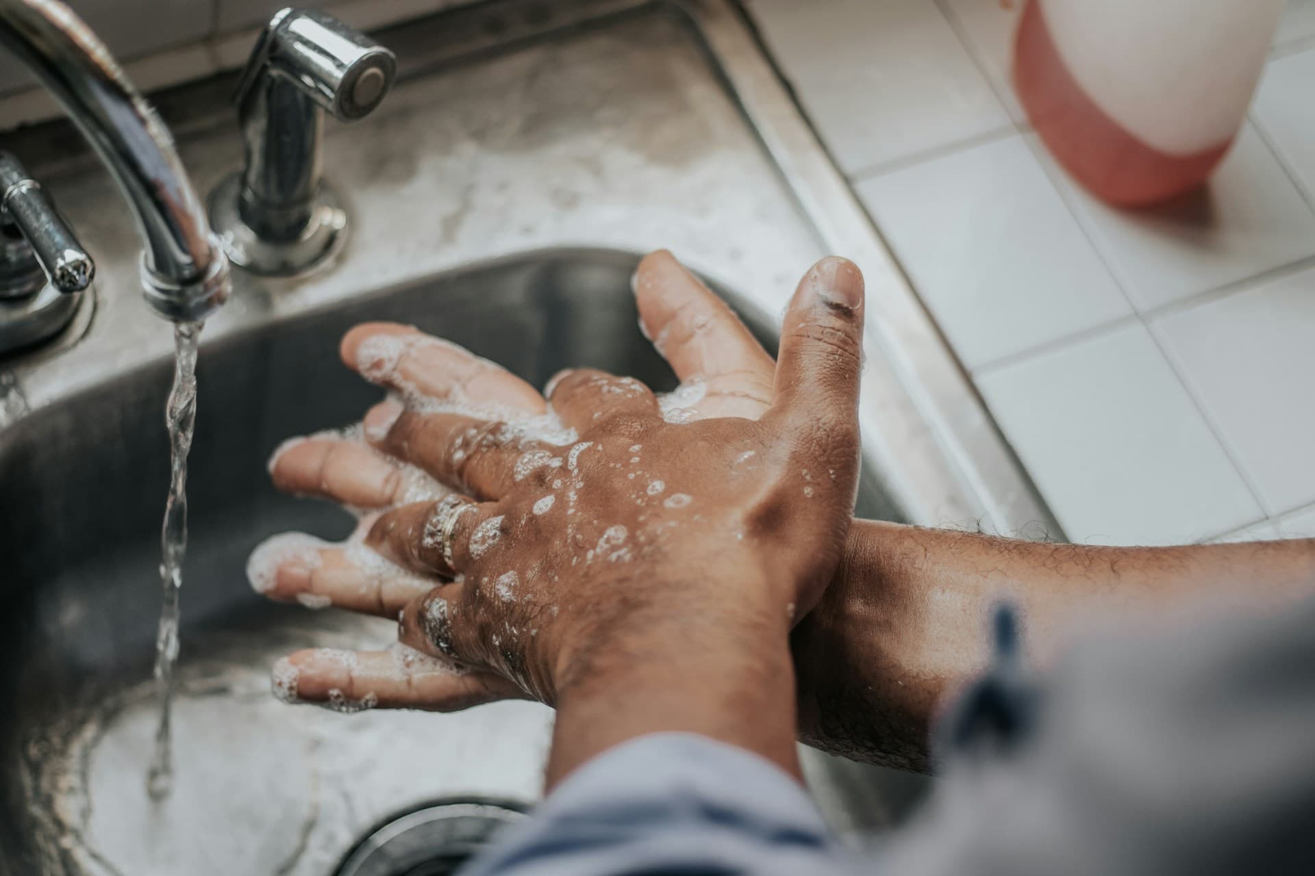 The Ultimate Guide to Managing Hand Eczema Expert Tips and Solutions